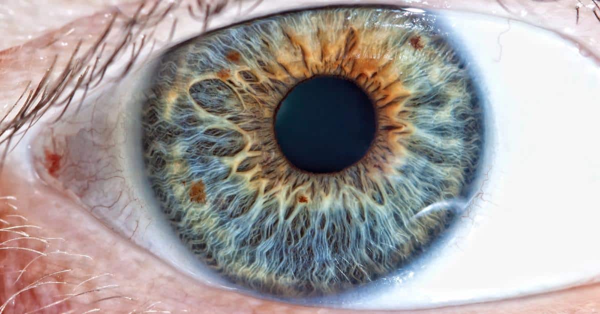 Azalea Vision